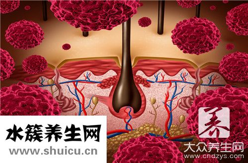頭皮毛囊堵塞