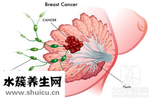 人類乳頭瘤