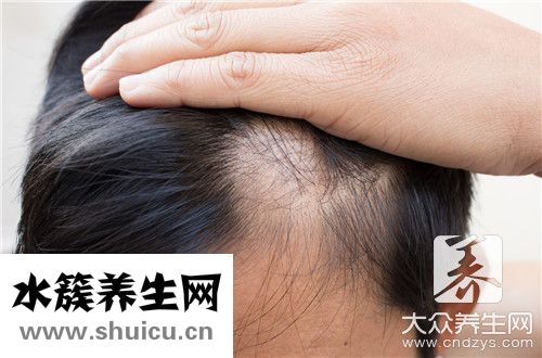 剛洗完頭發就有頭皮屑是了