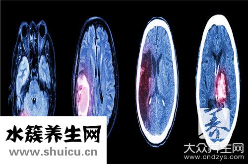 理解能力差是智商低嗎