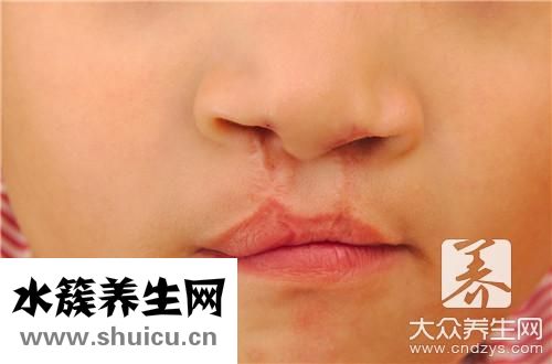 嘴唇干裂快速恢復