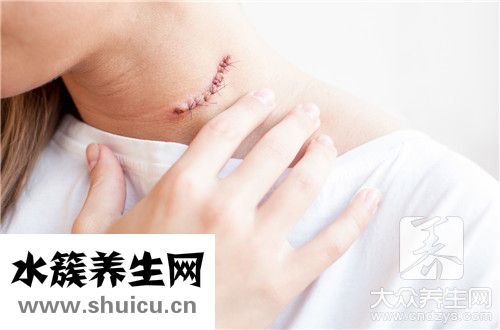 縱隔淋巴結轉移