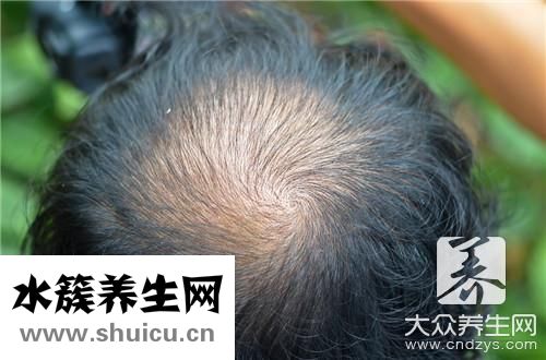 才能長頭發