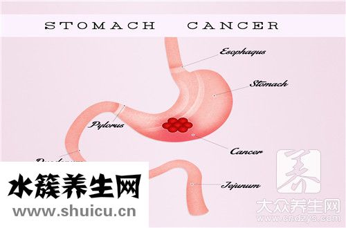 慢性胃炎伴糜爛嚴重嗎