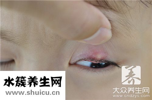 麥粒腫吃什么藥