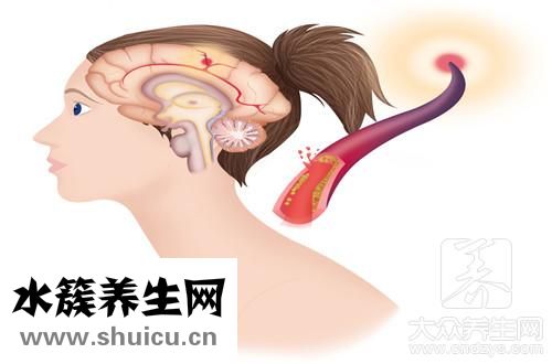 腦疝存活率