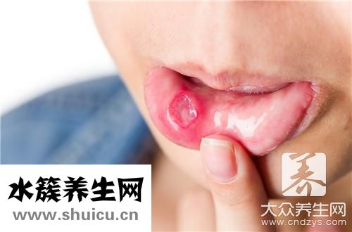 舌苔厚黃口臭吃什么藥