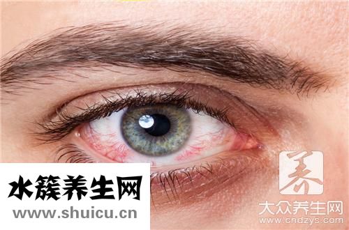 絲狀角膜炎