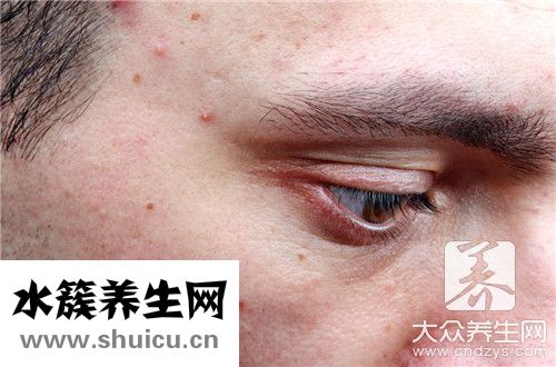 水痘坑修復