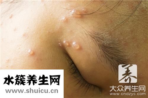 水痘坑修復