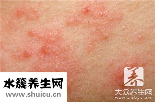 手掌長疙瘩