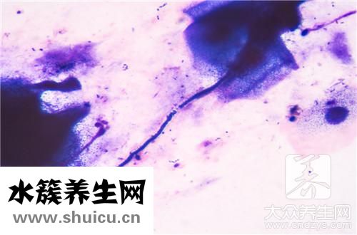 多重耐藥菌隔離措施