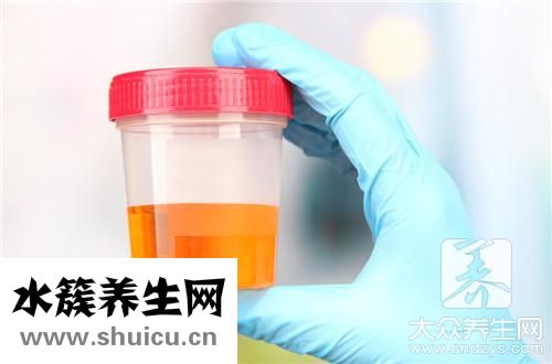 尿常規粘液絲高