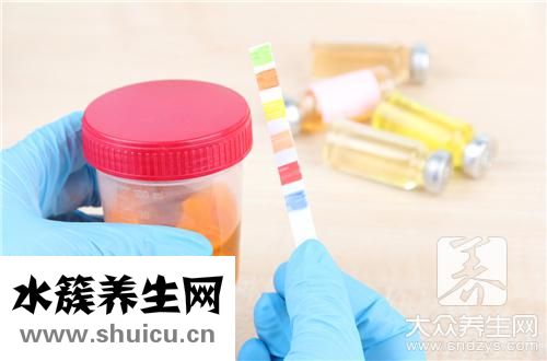 尿常規粘液絲高