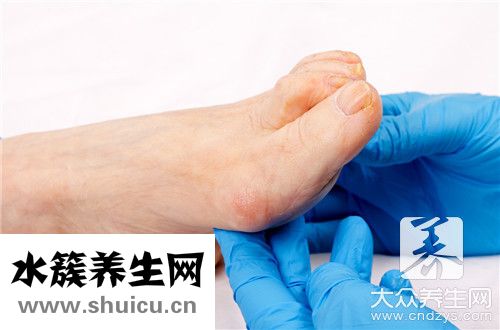 腳拇指疼