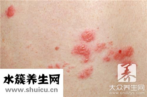 耳后有個硬疙瘩