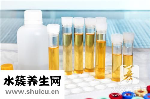尿常規粘液絲高