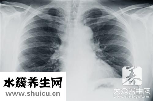 熬夜胸悶