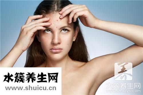 濕熱型痘痘