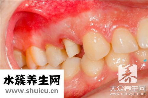牙一吸就出血還臭味