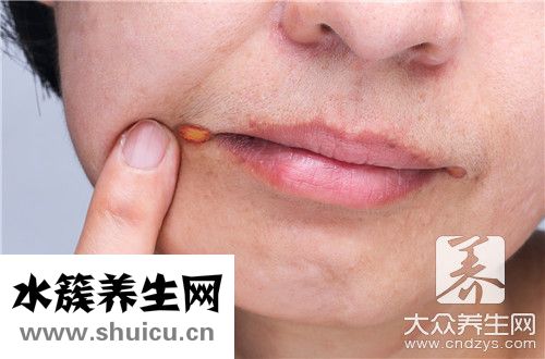 齦頰溝