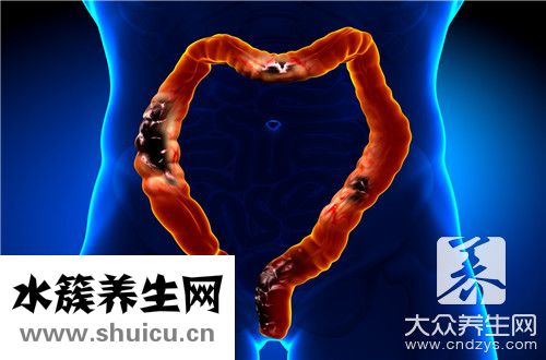 腸壁增厚