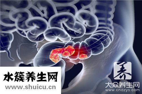 腸壁增厚