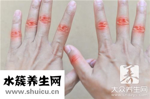 實性結節