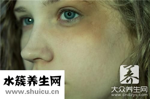 黑色素沉積