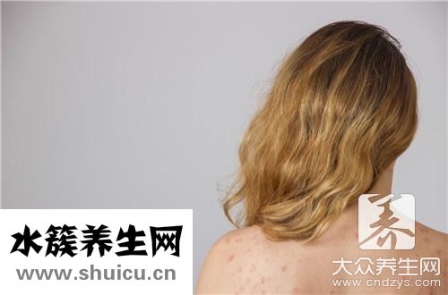 身上長白班是什么