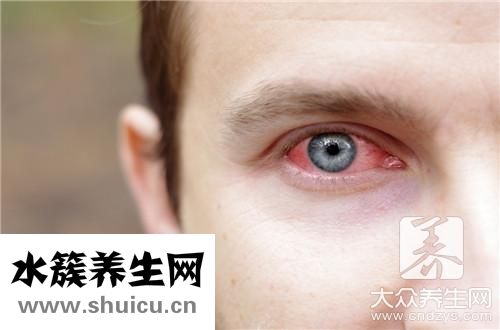 過敏眼藥水