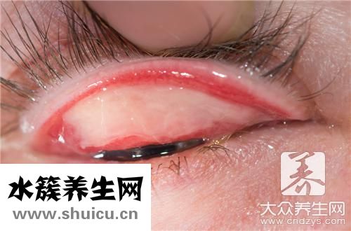 過敏眼藥水