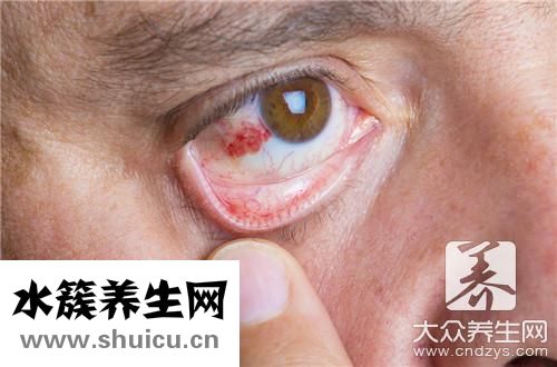 炎癥是引起