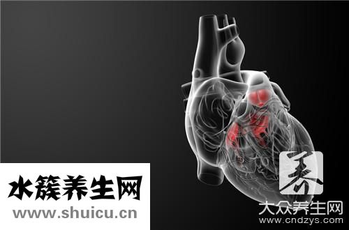 右位主動脈弓