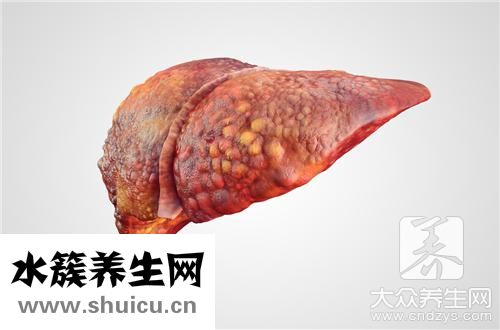 肝臟結節