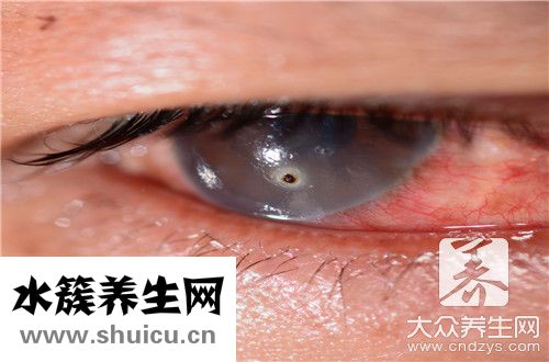 眼角干癢