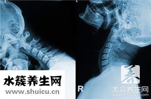 牽引療法