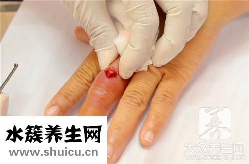 防水創可貼