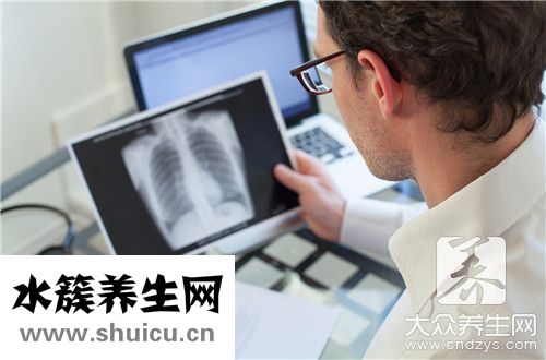 開放性肺結核