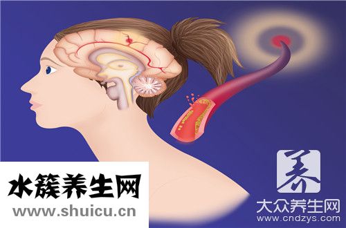 顱內囊腫