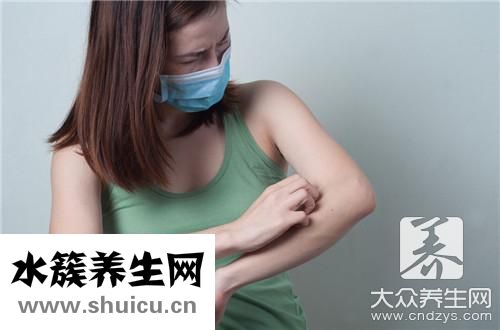 身上長紅點是什么病