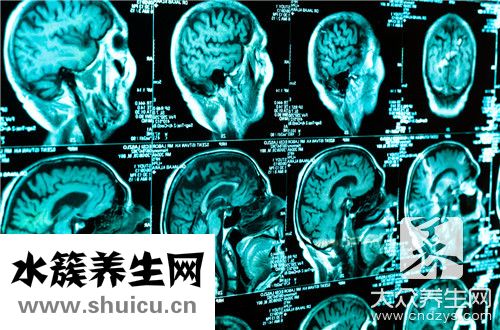 腦癌晚期