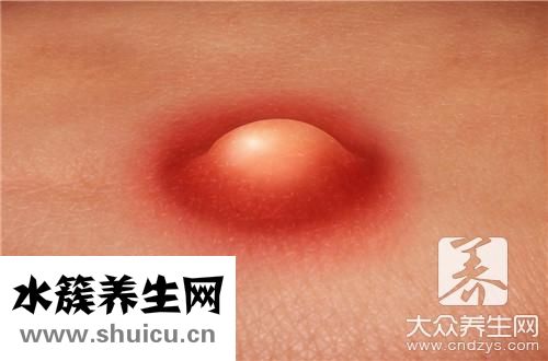 毛孔粗大用什么護膚品
