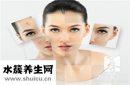 臉上擠出白色條狀是什么