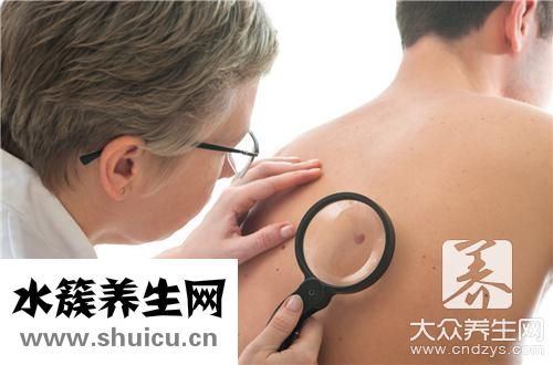 手術切痣