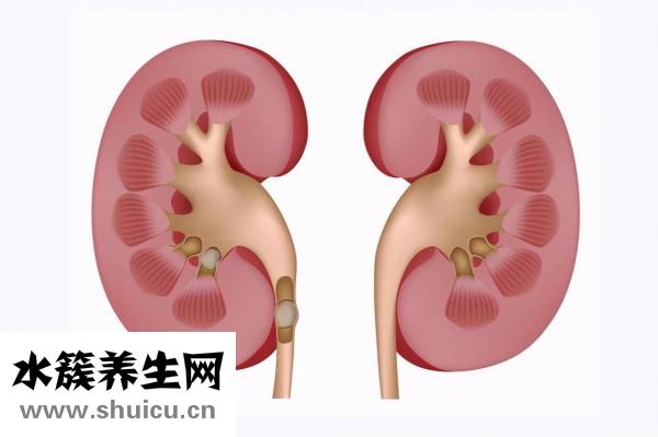 體外碎石費用