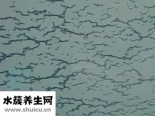 帕金森綜合征
