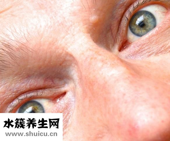 下眼皮皺紋