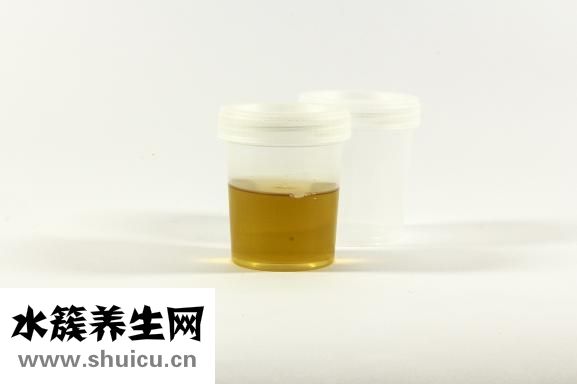 尿檢怎么看