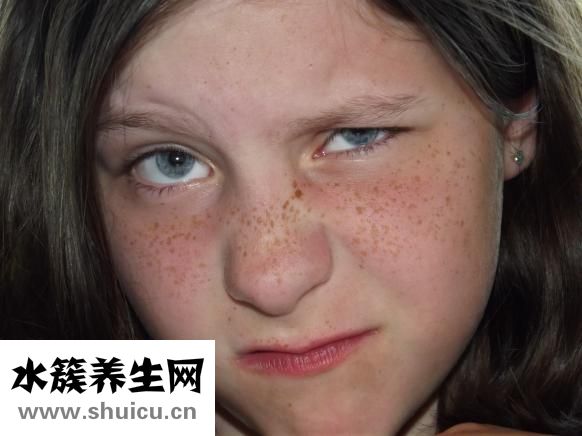 笑紋怎么去除